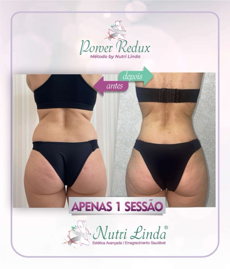 Antes e depois - Power Redux® - 1 sessão