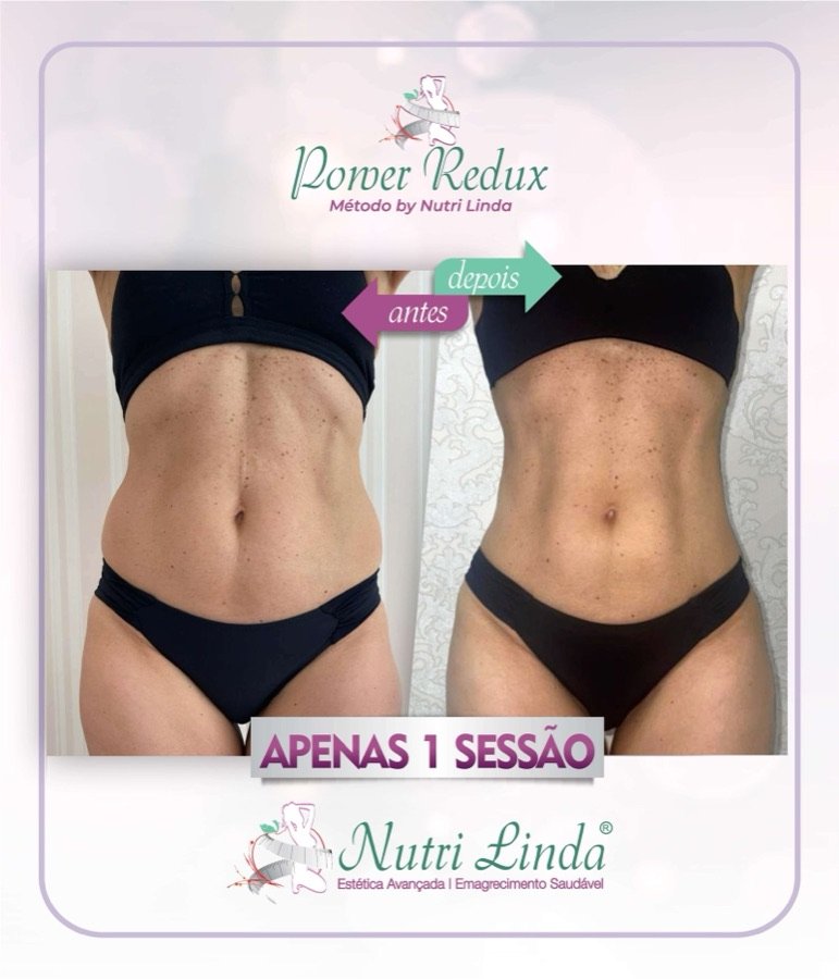 Antes e depois - Power Redux®