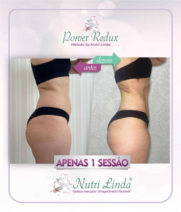 Antes e depois - Power Redux®