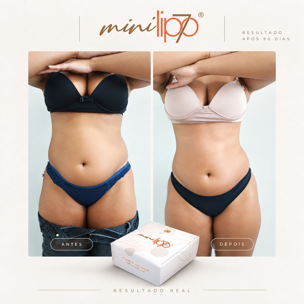 Antes e depois - Mini Lipo