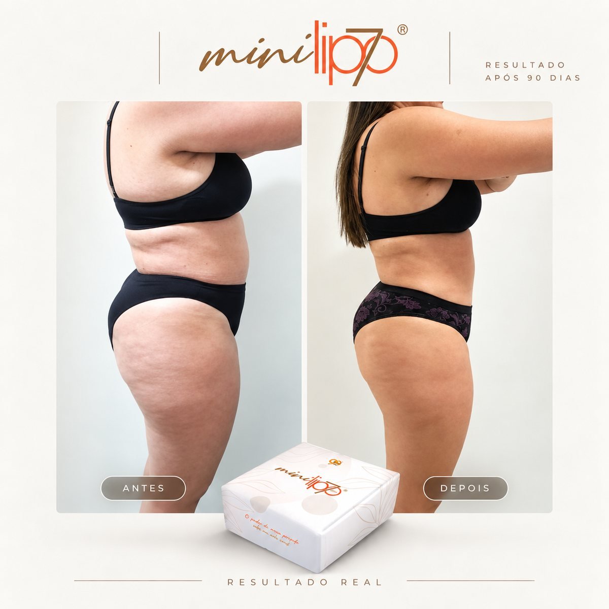 Antes e depois - Mini Lipo